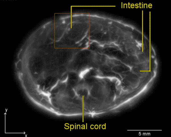 图为用光声成像技术生成的小鼠肠道图像。